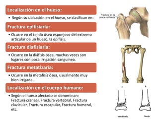 Localización en el hueso:
• Según su ubicación en el hueso, se clasifican en:
Fractura epifisiaria:
• Ocurre en el tejido óseo esponjoso del extremo
articular de un hueso, la epífisis.
Fractura diafisiaria:
• Ocurre en la diáfisis ósea, muchas veces son
lugares con poca irrigación sanguínea.
Fractura metatizaría:
• Ocurre en la metáfisis ósea, usualmente muy
bien irrigada.
Localización en el cuerpo humano:
• Según el hueso afectado se denominan:
Fractura craneal, Fractura vertebral, Fractura
clavicular, Fractura escapular, Fractura humeral,
etc.
 