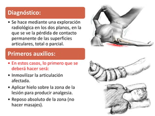Diagnóstico:
• Se hace mediante una exploración
radiológica en los dos planos, en la
que se ve la pérdida de contacto
permanente de las superficies
articulares, total o parcial.
Primeros auxilios:
• En estos casos, lo primero que se
deberá hacer será:
• Inmovilizar la articulación
afectada.
• Aplicar hielo sobre la zona de la
lesión para producir analgesia.
• Reposo absoluto de la zona (no
hacer masajes).
 