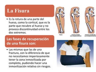 La Fisura
• Es la rotura de una parte del
hueso, como la cortical, que es la
parte que recubre al hueso y no
provoca discontinuidad entre los
dos extremos.
Las fases de recuperación
de una fisura son:
• Las mismas que las de una
fractura, con la diferencia de que
no necesitamos imperiosamente
tener la zona inmovilizada por
completo, pudiendo hacer una
inmovilización relativa sin riesgos.
 