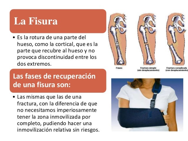 LESIONES MUSCULARES MAS COMUNES