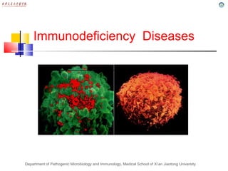 Department of Pathogenic Microbiology and Immunology, Medical School of Xi’an Jiaotong University
Immunodeficiency Diseases
 