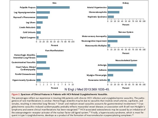 Cryoglobulinemia