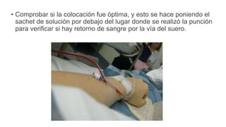 • Comprobar si la colocación fue óptima, y esto se hace poniendo el
sachet de solución por debajo del lugar donde se realizó la punción
para verificar si hay retorno de sangre por la vía del suero.
 