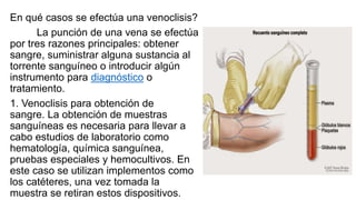 En qué casos se efectúa una venoclisis?
La punción de una vena se efectúa
por tres razones principales: obtener
sangre, suministrar alguna sustancia al
torrente sanguíneo o introducir algún
instrumento para diagnóstico o
tratamiento.
1. Venoclisis para obtención de
sangre. La obtención de muestras
sanguíneas es necesaria para llevar a
cabo estudios de laboratorio como
hematología, química sanguínea,
pruebas especiales y hemocultivos. En
este caso se utilizan implementos como
los catéteres, una vez tomada la
muestra se retiran estos dispositivos.
 