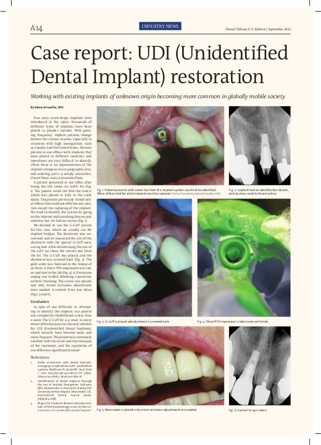 GCuff™ implant impression and unknown implants October 2012