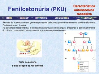 Fenilcetonúria (PKU)
Teste do pezinho
3 dias a seguir ao nascimento
CaracterísticaCaracterística
autossómicaautossómica
re...