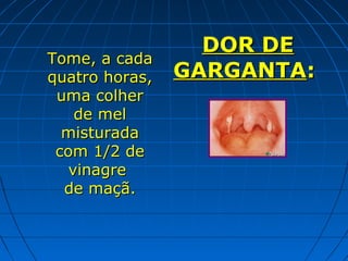 Tome, a cada
quatro horas,
uma colher
de mel
misturada
com 1/2 de
vinagre
de maçã.

DOR DE
GARGANTA:

 