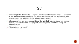  According to Dr. Frank Meshberger it correlates with major sulci of the cerebrum
in the inner and outer surface of the brain, the brain stem, the frontal lobe, the
basilar artery, the pituitary gland and the optic chiasma.
 Alternatively, it has been observed that the red cloth has the shape of a human
uterus ,and that the scarf hanging out, coloured green, could be a newly cut
umbilical cord.
 What is being discussed?
 