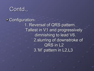 Contd.,Contd.,
Configuration-Configuration-
1. Reversal of QRS pattern.1. Reversal of QRS pattern.
Tallest in V1 and progressivelyTallest in V1 and progressively
dimnishing to lead V6.dimnishing to lead V6.
2.slurring of downstroke of2.slurring of downstroke of
QRS in L2QRS in L2
3.’M’ pattern in L2,L33.’M’ pattern in L2,L3
 