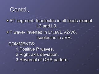 Contd.,Contd.,
ST segment- Isoelectric in all leads exceptST segment- Isoelectric in all leads except
L2 and L3.L2 and L3.
T wave- Inverted in L1,aVL,V2-V6.T wave- Inverted in L1,aVL,V2-V6.
isoelectric in aVR.isoelectric in aVR.
COMMENTS:COMMENTS:
1.Positive P waves.1.Positive P waves.
2.Right axis deviation.2.Right axis deviation.
3.Reversal of QRS pattern.3.Reversal of QRS pattern.
 