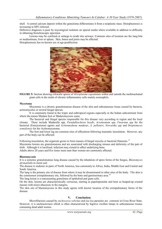 Inflammatory Conditions Mimicking Tumours In Calabar: A 30 Year Study (1978-2007).
www.iosrjournals.org 42 | Page
shell. A central calcium deposit within the granuloma differentiates it from a neoplastic mass. Histoplasmosis is
increasing in HIV-infected.
Definitive diagnosis is poor by mycological isolation on special media where available in addition to difficulty
in obtaining bronchoscopic specimen.
Lesions may be confined or enlarge to erode into airways. Common sites of location are the lung hila
or mediastinum, liver or spleen. Skin, bones and joints may be affected.
Histoplasmosis has no known sex or age predilection.
FIGURE 5: Section showing refractile spores of Histoplasma capsulatum within and outside the multinucleated
giant cells in the midst of chronic inflammatory cells mainly eosinophils.
Mycetoma
Mycetoma is a chronic granulomatous disease of the skin and subcutaneous tissue caused by bacteria,
actinomycetes or several fungal species.
It is commonly found in the tropic and subtropical regions especially in the Indian subcontinent from
where the names Madura foot or Maduromycosis came.
The bacterial and fungal species responsible for this disease vary according to region and the local
climate. These include Madurella spp, Pseudallescheria boydii, Acremonium spp, Fusarium spp for the
bacterial (Enmycetoma) agents and Actinomydurae madurae, A. pelletieri, Norcardia spp and Streptomyces
somaliensis for the Actinomycetoma.
The foot and lower leg are common sites of affectation following traumatic inoculation. However, any
part of the body can be affected.
Following inoculation, the organism grows to form masses of fungal mycelia or bacterial filaments.15
Mycetoma lesions are granulomatous and are associated with discharging sinuses and deformity of the part of
limb. Although it is localized, infection may extend to affect underlying bone.
Adults above 20 years and five times more men than women are commonly affected.
Blastomycosis
It is a systemic granulomatous lung disease caused by the inhalation of spore forms of the fungus, Blastomyces
dermatitidis in moist soil.
The disease is endemic in parts of North America, less commonly in Africa, India, Middle East and Central and
South America.
The lung is the primary site of disease from where it may be disseminated to other sites of the body. The skin is
the commonest extrapulmonary site, followed by the bone and genitourinary area.16
The lung lesion is a noncaseating granuloma of epitheloid and giant cells.
On the skin, lesions are characteristically verrucous, starting as papulopustular and later as heaped-up crusted
masses with micro abscesses in the margins.
The skin site of blastomycosis in this study agrees with known location of the extrapulmonary forms of the
disease.
V. Conclusion:
Microfilariasis caused by onchocerca volvolus and loa loa parasites are common in Cross River State.
However, it is onchocerciasis which is often characterized by fugitive swollen lumps in subcutaneous tissues
containing dead adult worms.
 