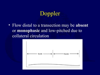 Doppler
• Flow distal to a transection may be absent
or monophasic and low-pitched due to
collateral circulation
 