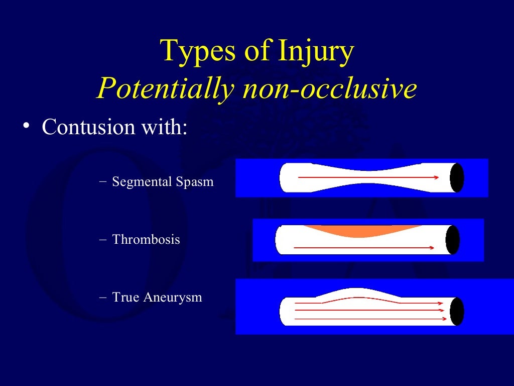 G03 Vascular Injury