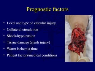 Prognostic factors
• Level and type of vascular injury
• Collateral circulation
• Shock/hypotension
• Tissue damage (crush injury)
• Warm ischemia time
• Patient factors/medical conditions
 