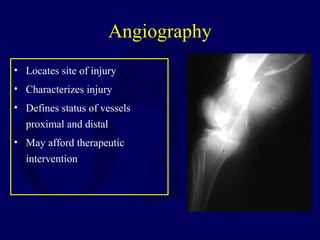 Angiography
• Locates site of injury
• Characterizes injury
• Defines status of vessels
proximal and distal
• May afford therapeutic
intervention
 
