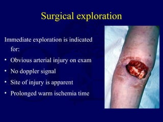Surgical exploration
Immediate exploration is indicated
for:
• Obvious arterial injury on exam
• No doppler signal
• Site of injury is apparent
• Prolonged warm ischemia time
 