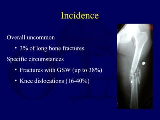 Incidence
Overall uncommon
• 3% of long bone fractures
Specific circumstances
• Fractures with GSW (up to 38%)
• Knee dislocations (16-40%)
 