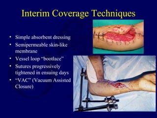 Interim Coverage Techniques
• Simple absorbent dressing
• Semipermeable skin-like
membrane
• Vessel loop “bootlace”
• Sutures progressively
tightened in ensuing days
• “VAC” (Vacuum Assisted
Closure)
 