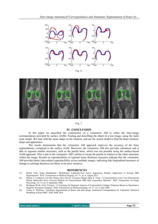 Inter-image Anatomical Correspondence and Automatic Segmentation of bones by…
||Issn 2250-3005 || || April || 2014 || Page 55
Fig. 6.
Fig. 7.
IV. CONCLUSION
In this paper we described the construction of a volumetric AM to refine the inter-image
correspondence provided by surface AAMs. Finding and describing the object in a test image, using the multi
scale model. We start with the mean shape on the location, and use the search model to find the Knee location,
shape and appearance.
The results demonstrate that the volumetric AM approach improves the accuracy of the bone
segmentations, compared to the surface AAM. Moreover, the volumetric AM also provides robustness and is
able to segment smaller structures, such as the patella bone, which was not possible using the surface-based
AAM approach. This is due to the volumetric AM‟s ability to locate the patella in relation to the other structures
within the image. Results on reproducibility of regional mean thickness measures indicate that the volumetric
AM provides better intra-subject reproducibility across multiple images, indicating that longitudinal measures of
change in cartilage thickness are likely to be more sensitive.
REFERENCES
[1] Robert Toth; Anant Madabhushi, “Multifeature Landmark-Free Active Appearance Models: Application to Prostate MRI
Segmentation”, IEEE Transactions on Medical Imaging, vol. 31, no. 8, August 2012.
[2] Martin A. Lindquist; Cun-Hui Zhang; Gary Glover; Lawrence Shepp; Qing X. Yang, “A Generalization of the Two-Dimensional
Prolate Spheroidal Wave Function Method for Nonrectilinear MRI Data Acquisition Methods”, IEEE Transactions on Image
Processing, vol. 15, no. 9, September 2006.
[3] Wolfgang Wirth; Felix Eckstein, “A Technique for Regional Analysis of Femorotibial Cartilage Thickness Based on Quantitative
Magnetic Resonance Imaging”, IEEE Transactions on Medical Imaging, vol. 27, no. 6, June 2008.
[4] Tomos G. Williams; “Automatic Segmentation of Bones and Inter-Image Anatomical Correspondence by Volumetric Statistical
Modelling of Knee MRI”, IEEE ISBI 2010.
 