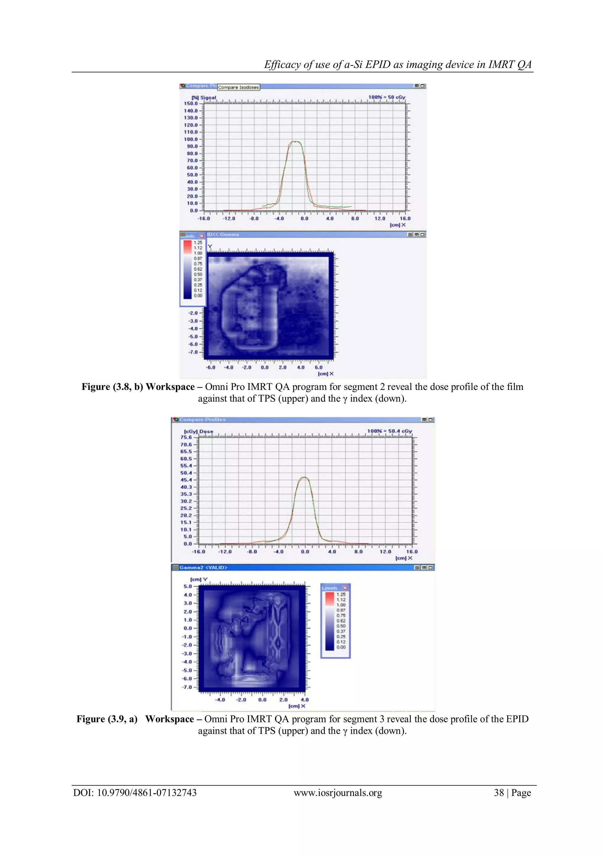 Efficacy of use of a-Si EPID as imaging device in IMRT QA
DOI: 10.9790/4861-07132743 www.iosrjournals.org 38 | Page
Figure (3.8, b) Workspace – Omni Pro IMRT QA program for segment 2 reveal the dose profile of the film
against that of TPS (upper) and the γ index (down).
Figure (3.9, a) Workspace – Omni Pro IMRT QA program for segment 3 reveal the dose profile of the EPID
against that of TPS (upper) and the γ index (down).
 