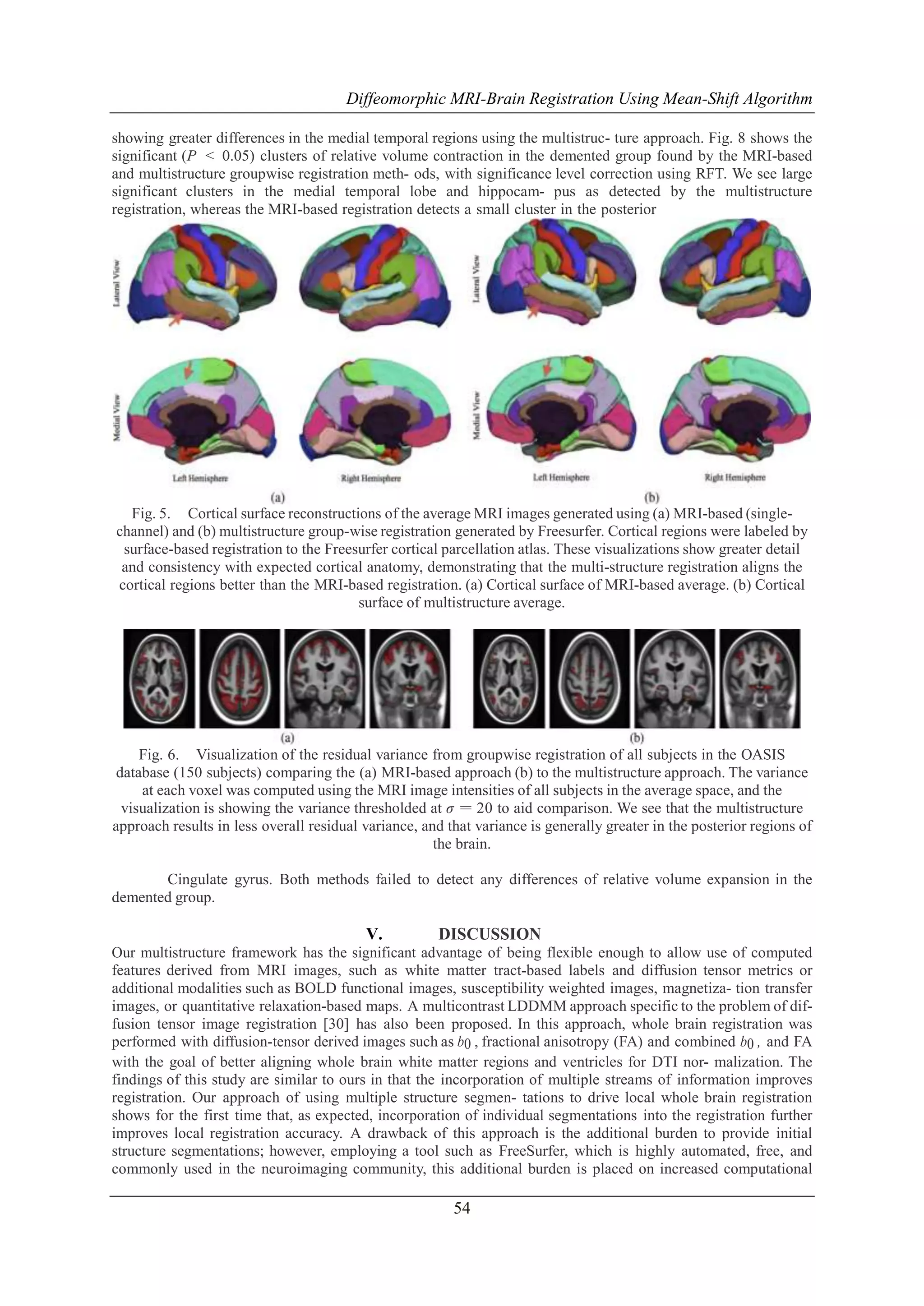 Diffeomorphic MRI-Brain Registration Using Mean-Shift Algorithm
showing greater differences in the medial temporal regions using the multistruc- ture approach. Fig. 8 shows the
significant (P < 0.05) clusters of relative volume contraction in the demented group found by the MRI-based
and multistructure groupwise registration meth- ods, with significance level correction using RFT. We see large
significant clusters in the medial temporal lobe and hippocam- pus as detected by the multistructure
registration, whereas the MRI-based registration detects a small cluster in the posterior

Fig. 5. Cortical surface reconstructions of the average MRI images generated using (a) MRI-based (singlechannel) and (b) multistructure group-wise registration generated by Freesurfer. Cortical regions were labeled by
surface-based registration to the Freesurfer cortical parcellation atlas. These visualizations show greater detail
and consistency with expected cortical anatomy, demonstrating that the multi-structure registration aligns the
cortical regions better than the MRI-based registration. (a) Cortical surface of MRI-based average. (b) Cortical
surface of multistructure average.

Fig. 6. Visualization of the residual variance from groupwise registration of all subjects in the OASIS
database (150 subjects) comparing the (a) MRI-based approach (b) to the multistructure approach. The variance
at each voxel was computed using the MRI image intensities of all subjects in the average space, and the
visualization is showing the variance thresholded at σ = 20 to aid comparison. We see that the multistructure
approach results in less overall residual variance, and that variance is generally greater in the posterior regions of
the brain.
Cingulate gyrus. Both methods failed to detect any differences of relative volume expansion in the
demented group.

V.

DISCUSSION

Our multistructure framework has the significant advantage of being flexible enough to allow use of computed
features derived from MRI images, such as white matter tract-based labels and diffusion tensor metrics or
additional modalities such as BOLD functional images, susceptibility weighted images, magnetiza- tion transfer
images, or quantitative relaxation-based maps. A multicontrast LDDMM approach specific to the problem of diffusion tensor image registration [30] has also been proposed. In this approach, whole brain registration was
performed with diffusion-tensor derived images such as b0 , fractional anisotropy (FA) and combined b0 , and FA
with the goal of better aligning whole brain white matter regions and ventricles for DTI nor- malization. The
findings of this study are similar to ours in that the incorporation of multiple streams of information improves
registration. Our approach of using multiple structure segmen- tations to drive local whole brain registration
shows for the first time that, as expected, incorporation of individual segmentations into the registration further
improves local registration accuracy. A drawback of this approach is the additional burden to provide initial
structure segmentations; however, employing a tool such as FreeSurfer, which is highly automated, free, and
commonly used in the neuroimaging community, this additional burden is placed on increased computational

54

 