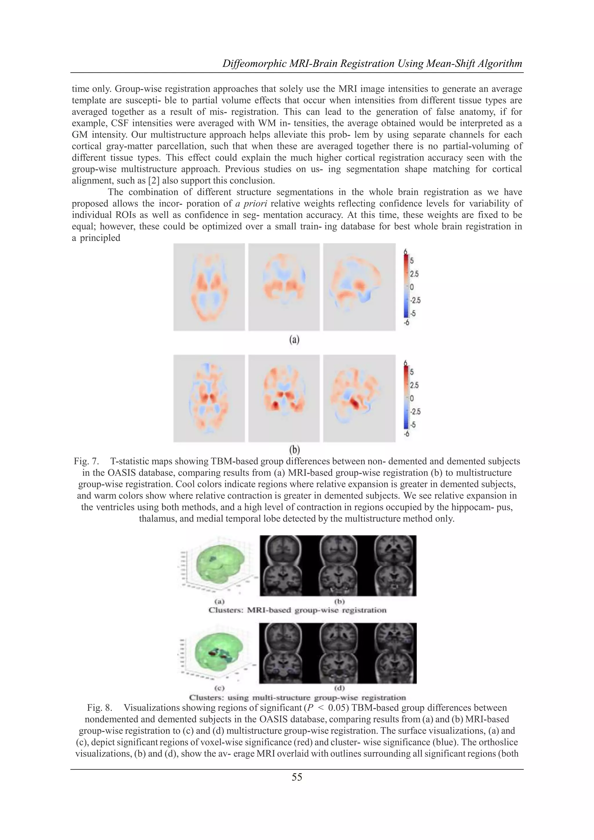 Diffeomorphic MRI-Brain Registration Using Mean-Shift Algorithm
time only. Group-wise registration approaches that solely use the MRI image intensities to generate an average
template are suscepti- ble to partial volume effects that occur when intensities from different tissue types are
averaged together as a result of mis- registration. This can lead to the generation of false anatomy, if for
example, CSF intensities were averaged with WM in- tensities, the average obtained would be interpreted as a
GM intensity. Our multistructure approach helps alleviate this prob- lem by using separate channels for each
cortical gray-matter parcellation, such that when these are averaged together there is no partial-voluming of
different tissue types. This effect could explain the much higher cortical registration accuracy seen with the
group-wise multistructure approach. Previous studies on us- ing segmentation shape matching for cortical
alignment, such as [2] also support this conclusion.
The combination of different structure segmentations in the whole brain registration as we have
proposed allows the incor- poration of a priori relative weights reflecting confidence levels for variability of
individual ROIs as well as confidence in seg- mentation accuracy. At this time, these weights are fixed to be
equal; however, these could be optimized over a small train- ing database for best whole brain registration in
a principled

Fig. 7. T-statistic maps showing TBM-based group differences between non- demented and demented subjects
in the OASIS database, comparing results from (a) MRI-based group-wise registration (b) to multistructure
group-wise registration. Cool colors indicate regions where relative expansion is greater in demented subjects,
and warm colors show where relative contraction is greater in demented subjects. We see relative expansion in
the ventricles using both methods, and a high level of contraction in regions occupied by the hippocam- pus,
thalamus, and medial temporal lobe detected by the multistructure method only.

Fig. 8. Visualizations showing regions of significant (P < 0.05) TBM-based group differences between
nondemented and demented subjects in the OASIS database, comparing results from (a) and (b) MRI-based
group-wise registration to (c) and (d) multistructure group-wise registration. The surface visualizations, (a) and
(c), depict significant regions of voxel-wise significance (red) and cluster- wise significance (blue). The orthoslice
visualizations, (b) and (d), show the av- erage MRI overlaid with outlines surrounding all significant regions (both

55

 