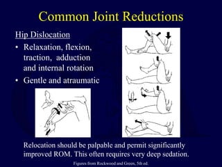 Common Joint Reductions
Hip Dislocation
• Relaxation, flexion,
traction, adduction
and internal rotation
• Gentle and atraumatic
Relocation should be palpable and permit significantly
improved ROM. This often requires very deep sedation.
Figures from Rockwood and Green, 5th ed.
 