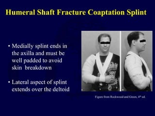• Medially splint ends in
the axilla and must be
well padded to avoid
skin breakdown
• Lateral aspect of splint
extends over the deltoid
Figure from Rockwood and Green, 4th ed.
Humeral Shaft Fracture Coaptation Splint
 