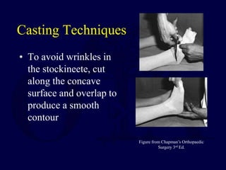 Casting Techniques
• To avoid wrinkles in
the stockineete, cut
along the concave
surface and overlap to
produce a smooth
contour
Figure from Chapman’s Orthopaedic
Surgery 3rd Ed.
 
