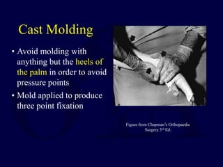 Figure from Chapman’s Orthopaedic
Surgery 3rd Ed.
• Avoid molding with
anything but the heels of
the palm in order to avoid
pressure points
• Mold applied to produce
three point fixation
Cast Molding
 