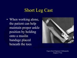 Short Leg Cast
• When working alone,
the patient can help
maintain proper ankle
position by holding
onto a muslin
bandage placed
beneath the toes
Figure from Chapman’s Orthopaedic
Surgery 3rd Ed.
 
