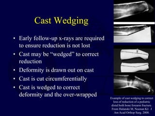 Cast Wedging
• Early follow-up x-rays are required
to ensure reduction is not lost
• Cast may be “wedged” to correct
reduction
• Deformity is drawn out on cast
• Cast is cut circumferentially
• Cast is wedged to correct
deformity and the over-wrapped Example of cast wedging to correct
loss of reduction of a pediatric
distal both bone forearm fracture.
From Halanski M, Noonan KJ. J
Am Acad Orthop Surg. 2008.
 