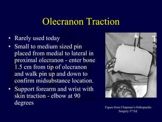 Olecranon Traction
• Rarely used today
• Small to medium sized pin
placed from medial to lateral in
proximal olecranon - enter bone
1.5 cm from tip of olecranon
and walk pin up and down to
confirm midsubstance location.
• Support forearm and wrist with
skin traction - elbow at 90
degrees
Figure from Chapman’s Orthopaedic
Surgery 3rd Ed.
 