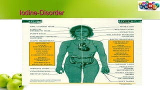 Iodine-Disorder
 
