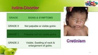 Iodine-Disorder
39
GRADE SIGNS & SYMPTOMS
GRADE 0 Not palpable or visible goitre.
GRADE 1 Palpable but not visible goitre.
GRADE 2 Visible, Swelling of neck &
enlargement of goitre.
 