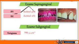 Jens Martensson 12
Exame Supragengival
Exame Subgengival
IPV
ISG
Periograma
Aceitável: 30%
Aceitável: 10%
PSR: 3, 4 ou *
 