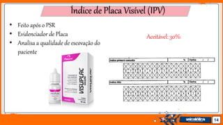 Jens Martensson 14
Índice de Placa Visível (IPV)
• Feito após o PSR
• Evidenciador de Placa
• Analisa a qualidade de escovação do
paciente
Aceitável: 30%
 