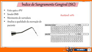 Jens Martensson 15
Índice de Sangramento Gengival (ISG)
• Feito após o IPV
• Sonda OMS
• Movimento de varredura
• Analisa a qualidade da escovação do
paciente
Aceitável: 10%
 