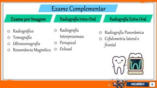 Jens Martensson 8
Exame Complementar
ExameporImagem
o Radiografia Panorâmica
o Cefalometria lateral e
frontal
RadiografiaExtra-OralRadiografiaIntra-Oral
o Radiografia
Interproximais
o Periapical
o Oclusal
o Radiográfico
o Tomografia
o Ultrassonografia
o Ressonância Magnética
 