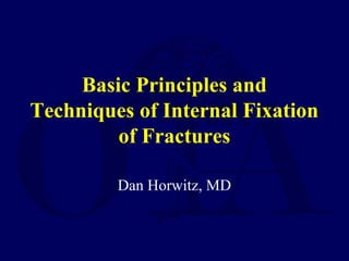 Basic Principles and
Techniques of Internal Fixation
of Fractures
Dan Horwitz, MD
 