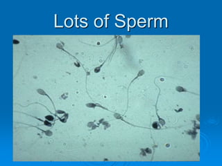 Lots of Sperm
 