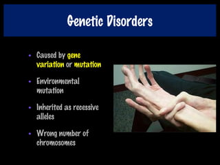 Genetic Disorders
• Caused by gene
variation or mutation
• Environmental
mutation
• Inherited as recessive
alleles
• Wrong number of
chromosomes
 