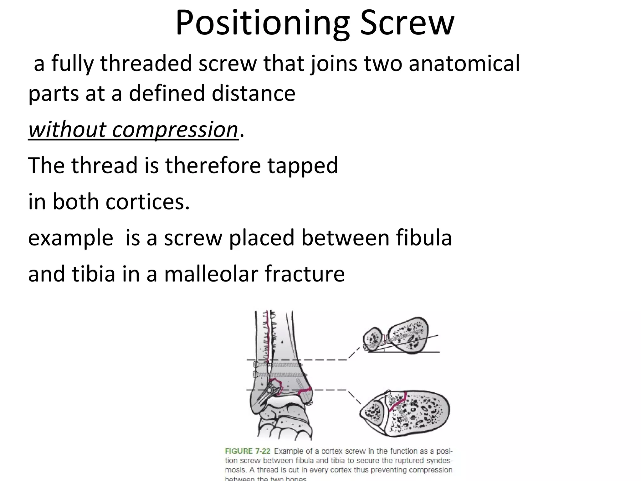 principles of internal fixation | PPT