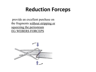 Reduction Forceps
provide an excellent purchase on
the fragments without stripping or
squeezing the periosteum
EG WEBERS F...