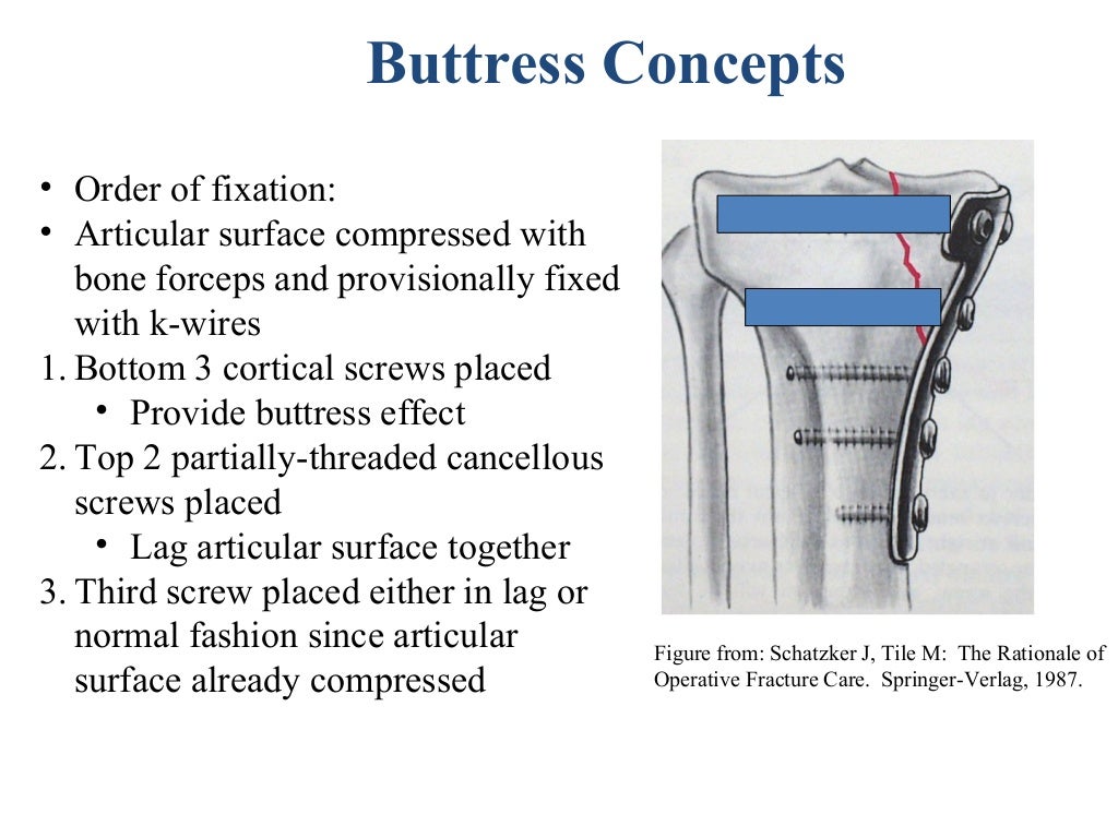 principles of internal fixation
