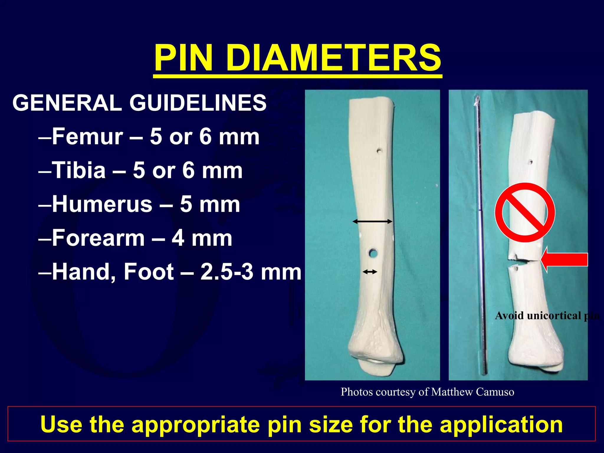 G11-Principles of External Fixation.pdf