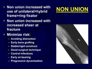 NON UNION
• Non union increased with
use of unilateral>hybrid
frame>ring fixator
• Non union increased with
increased sheer at
fracture
• Minimize risk:
– Avoiding distraction
– Early bone grafting
– Stable/rigid construct
– Good surgical technique
– Control infections
– Early wt bearing
– Progressive dynamization
 