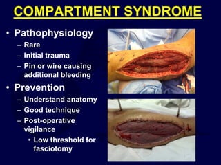 COMPARTMENT SYNDROME
• Pathophysiology
– Rare
– Initial trauma
– Pin or wire causing
additional bleeding
• Prevention
– Understand anatomy
– Good technique
– Post-operative
vigilance
• Low threshold for
fasciotomy
 
