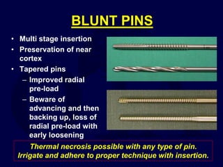 BLUNT PINS
• Multi stage insertion
• Preservation of near
cortex
• Tapered pins
– Improved radial
pre-load
– Beware of
advancing and then
backing up, loss of
radial pre-load with
early loosening
Thermal necrosis possible with any type of pin.
Irrigate and adhere to proper technique with insertion.
 