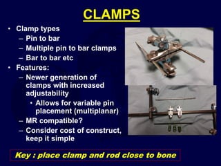 CLAMPS
• Clamp types
– Pin to bar
– Multiple pin to bar clamps
– Bar to bar etc
• Features:
– Newer generation of
clamps with increased
adjustability
• Allows for variable pin
placement (multiplanar)
– MR compatible?
– Consider cost of construct,
keep it simple
Key : place clamp and rod close to bone
 